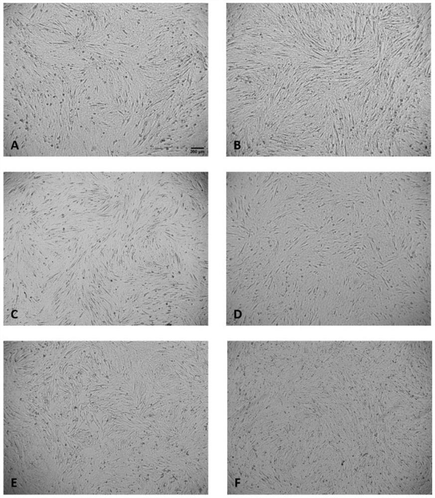 Application of flavonoid compound in induction of muscle-derived cell in-vitro efficient differentiation