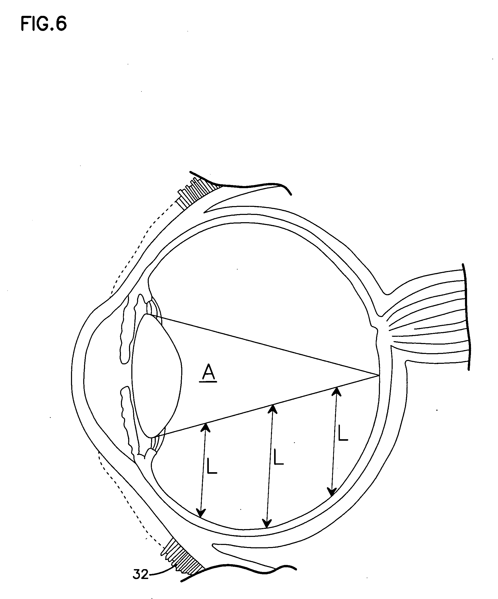 Medical devices and methods for producing the same