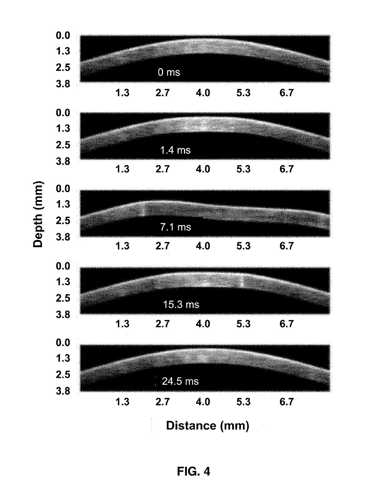 System and Method for Measuring Intraocular Pressure and Ocular Tissue Biomechanical Properties