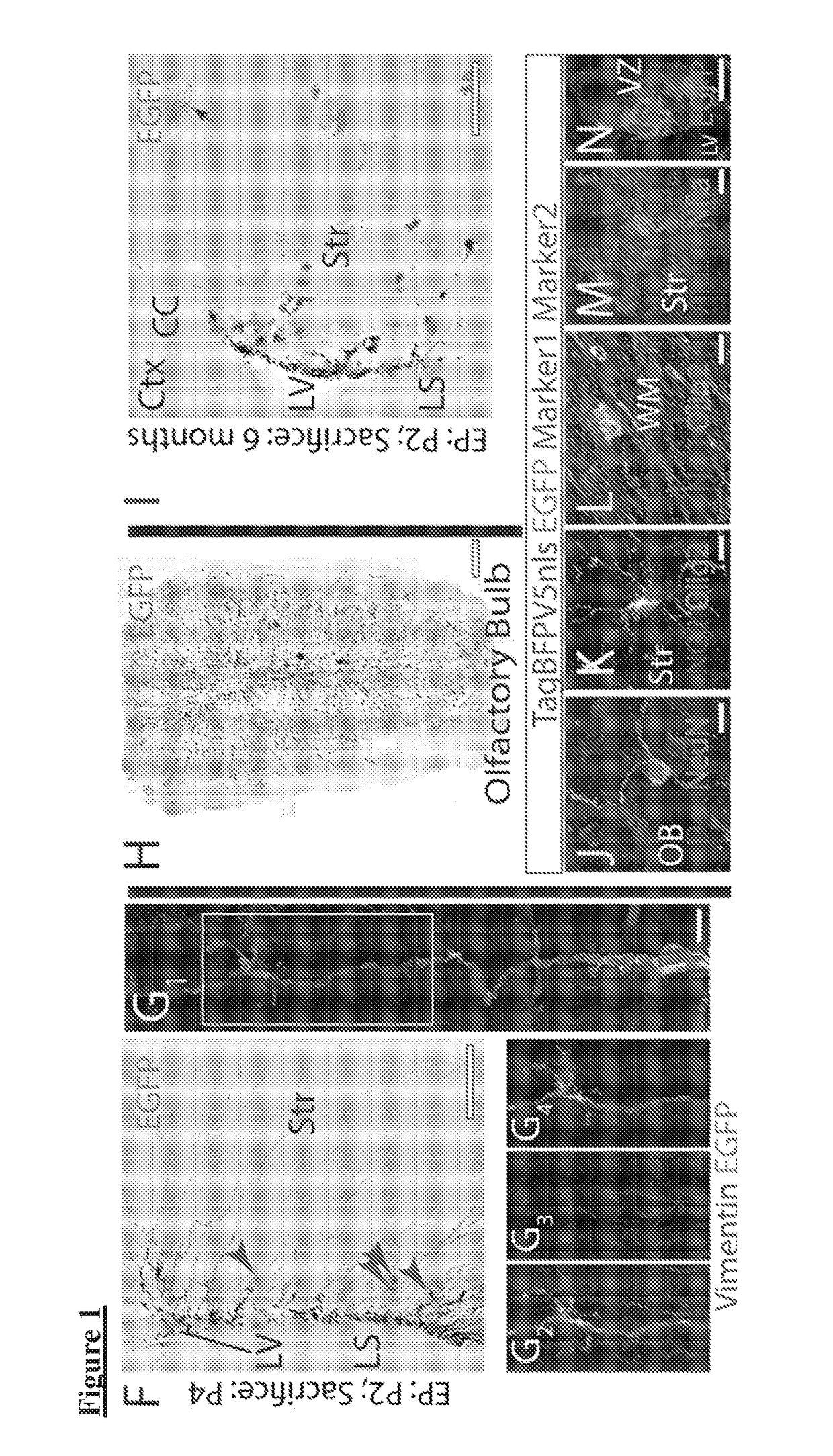 Ets factors regulate neural stem cell depletion and gliogenesis in ras pathway glioma