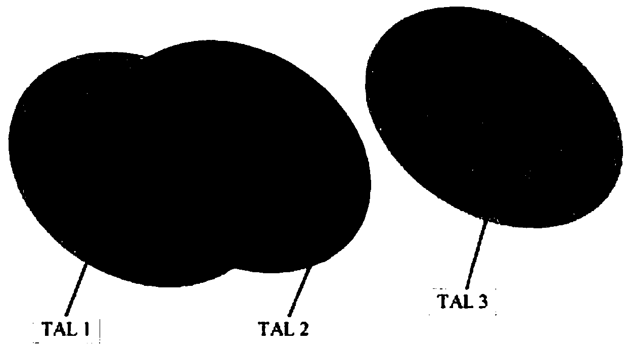 Tracking area list management method based on overlapping community detection in small cellular network