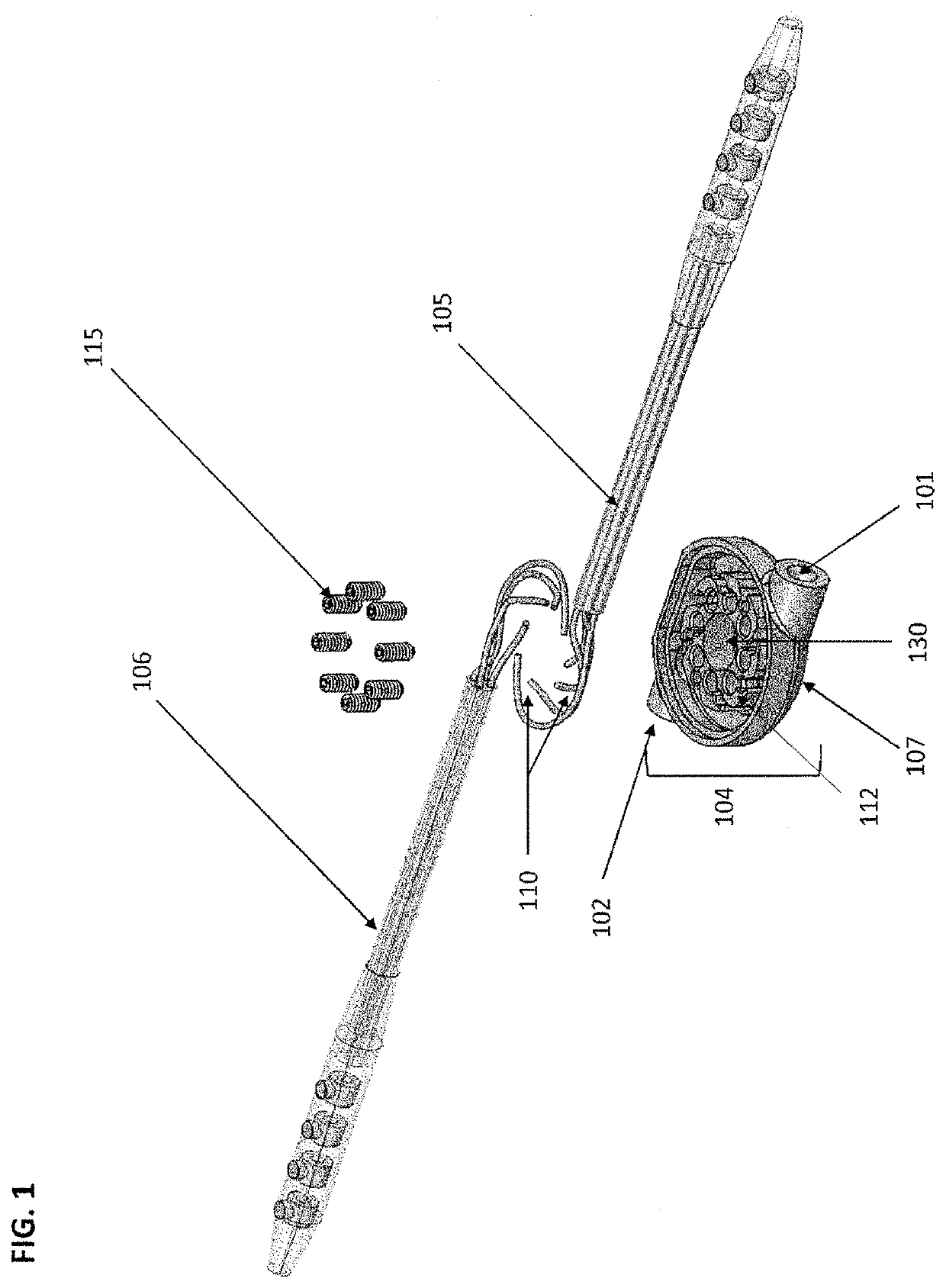 Method and System of Dorsal Root Ganglion Stimulation