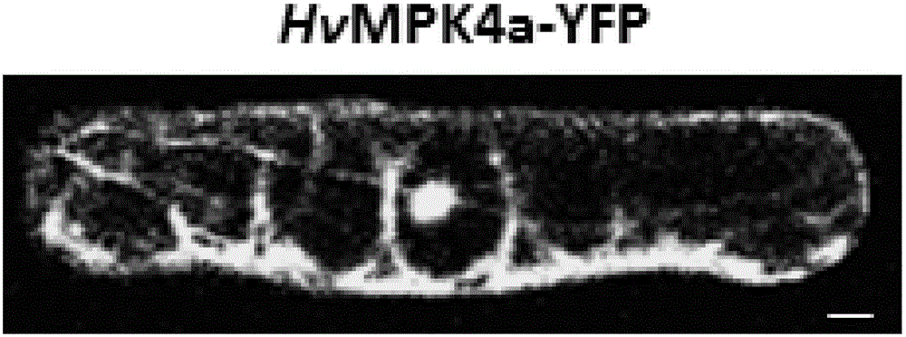 Protein kinase HvMPK4a related to barley powdery mildew resistance and encoding gene and application of protein kinase HvMPK4a