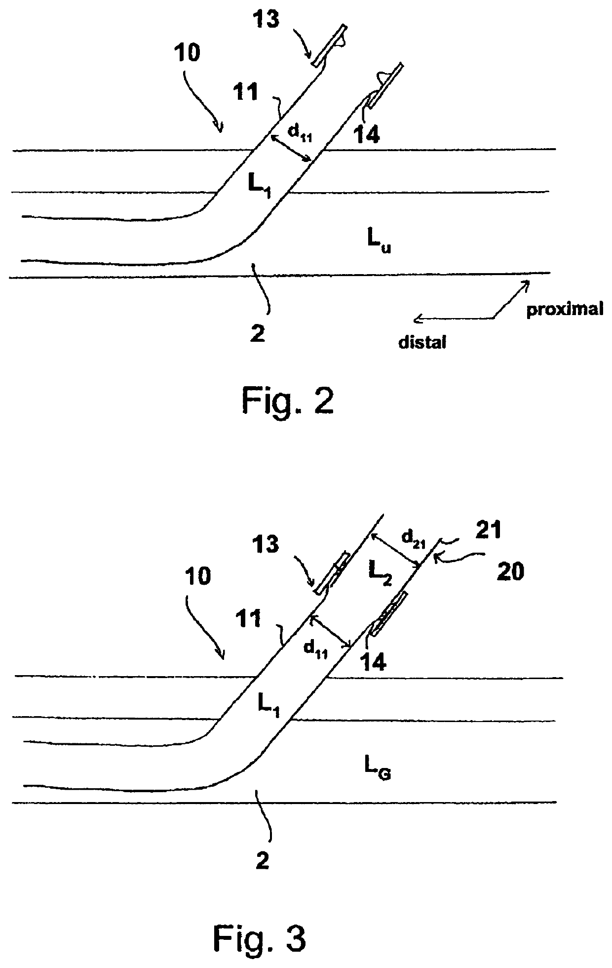 Sheath device for inserting a catheter
