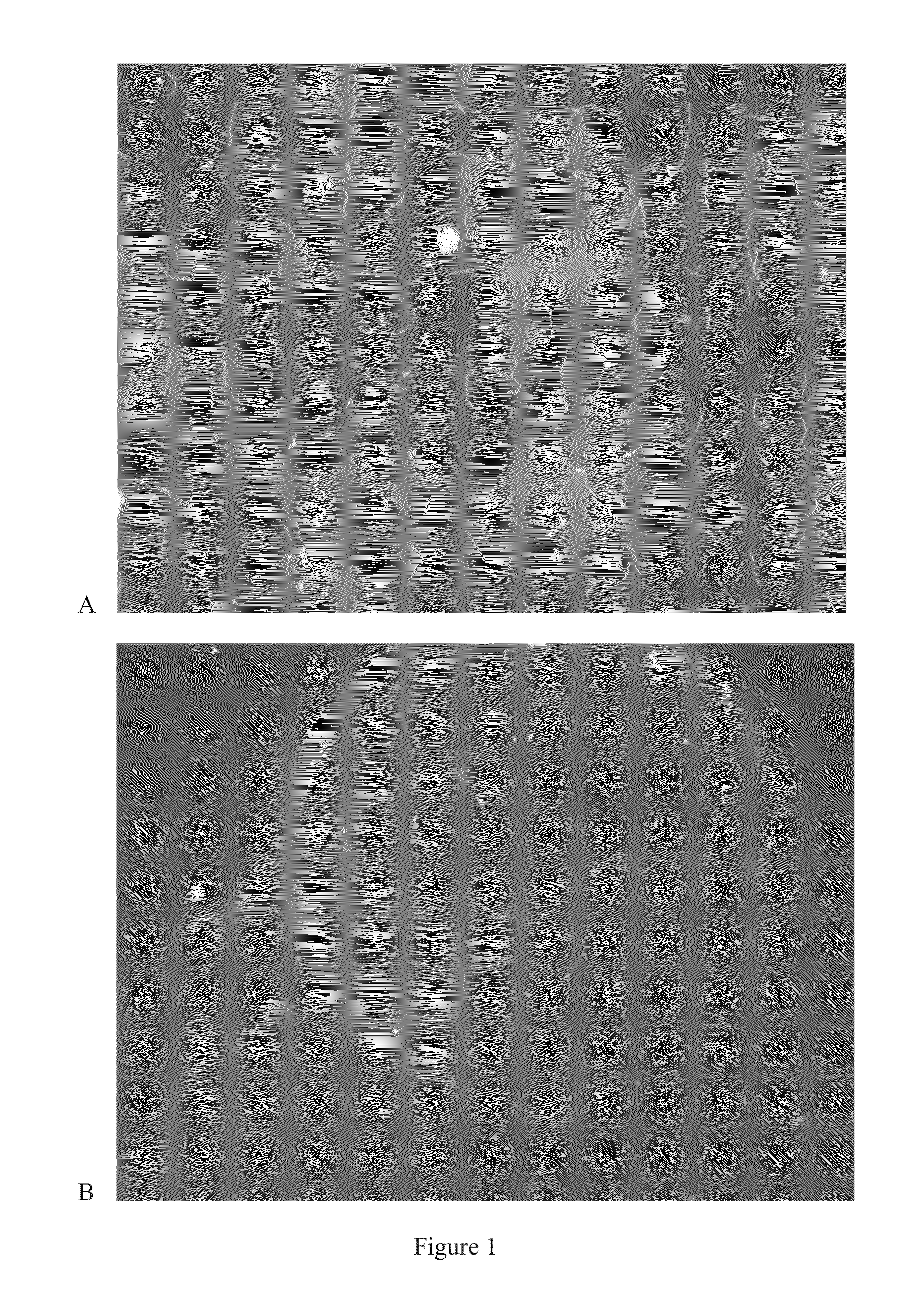 Compositions and methods for culturing spirochetes