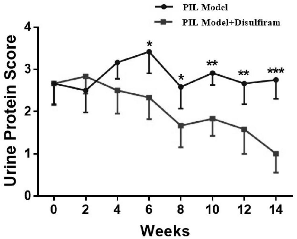 Application of disulfiram to preparation of drug for treating systemic lupus erythematosus
