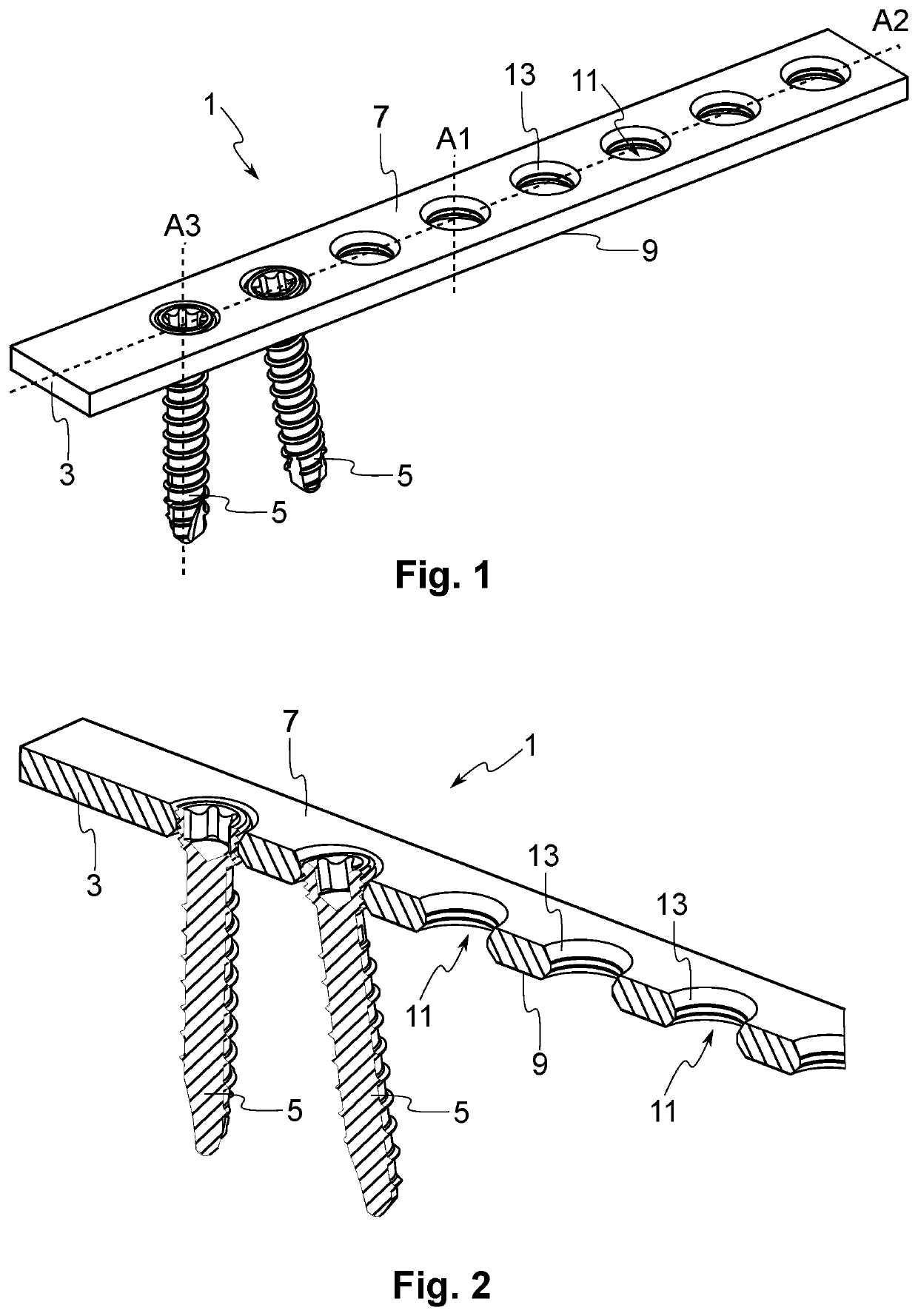Bone plate system comprising a fastening element having a hard surface