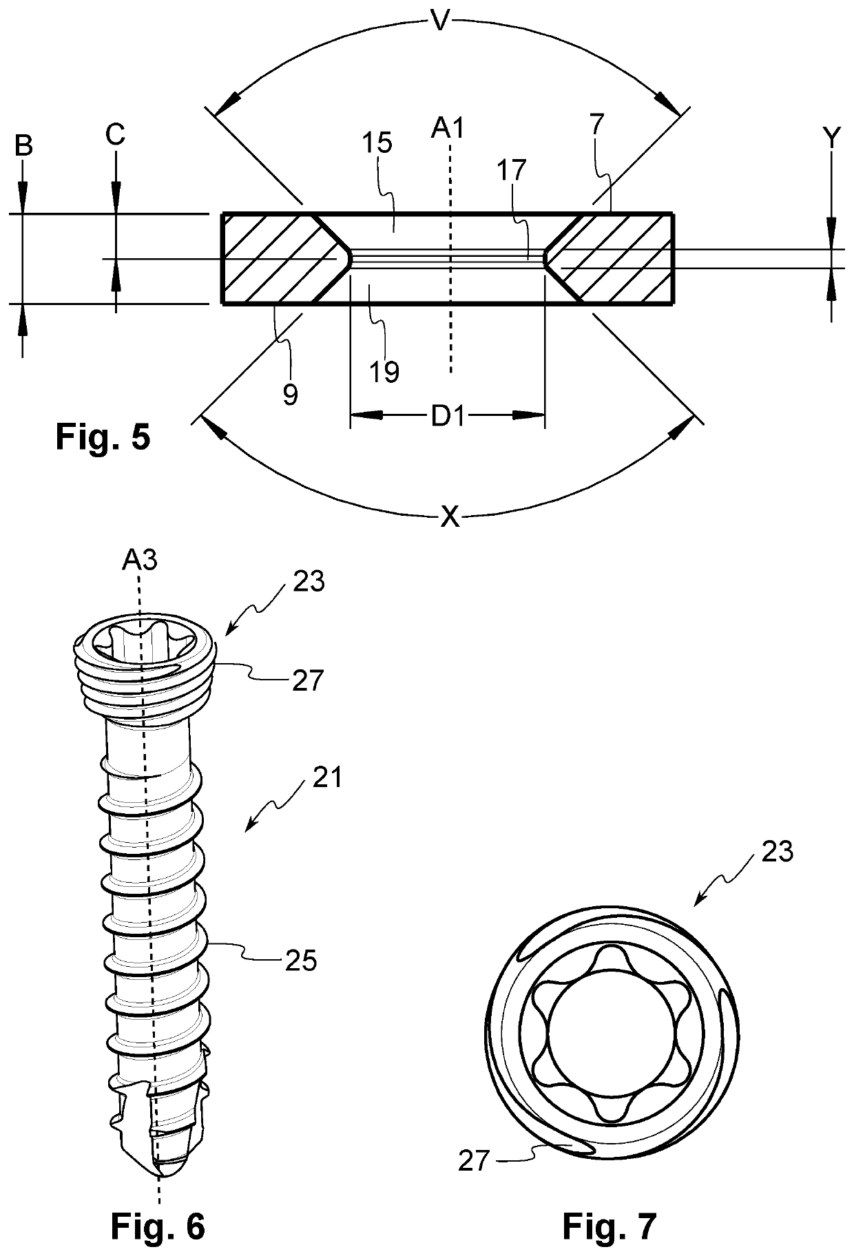 Bone plate system comprising a fastening element having a hard surface