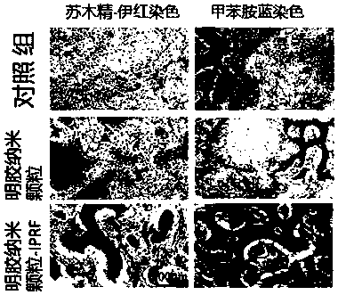 Injectable high-strength composite hydrogel based on colloidal particle-iPRF double network structure, and preparation method and application thereof