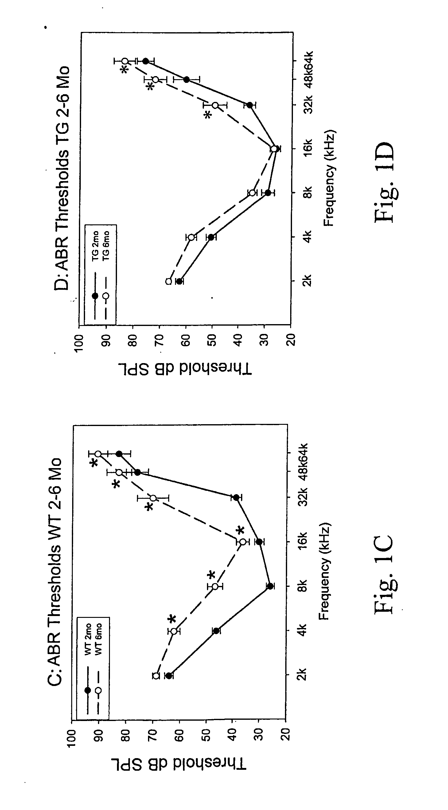 Method of treating or preventing hearing loss