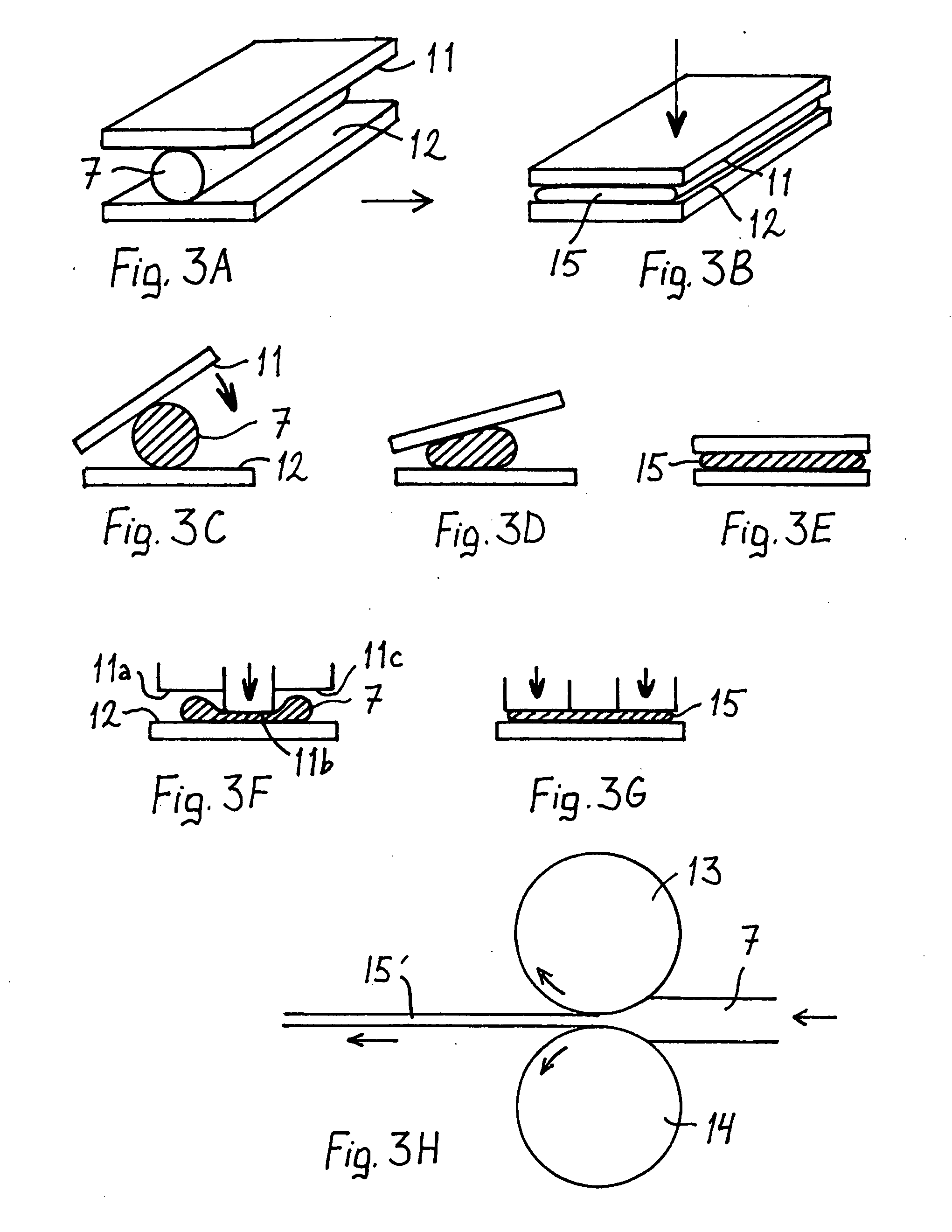Bioabsorbable, deformable fixation material and implant