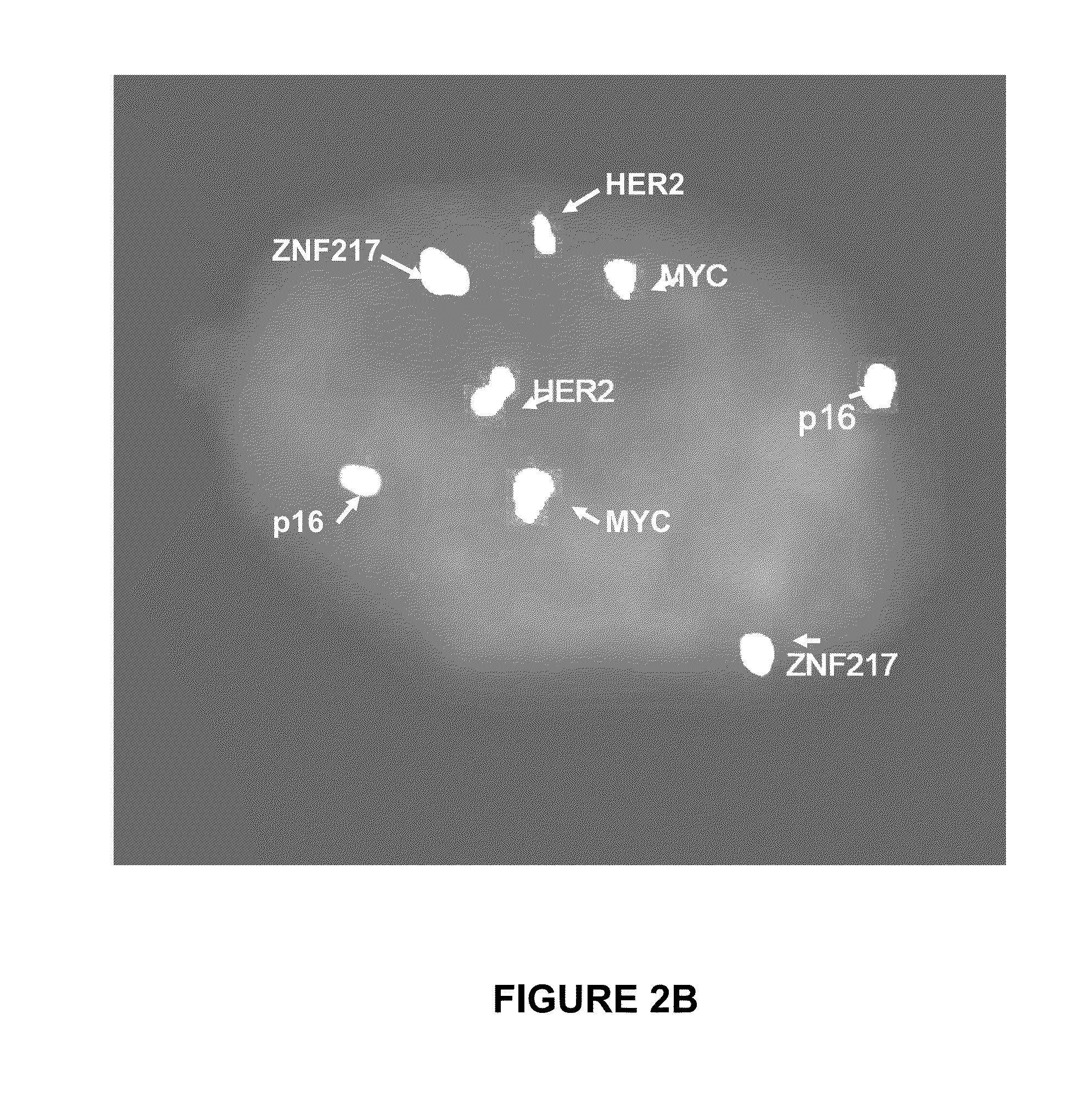 Methods for early detection of esophageal cancer