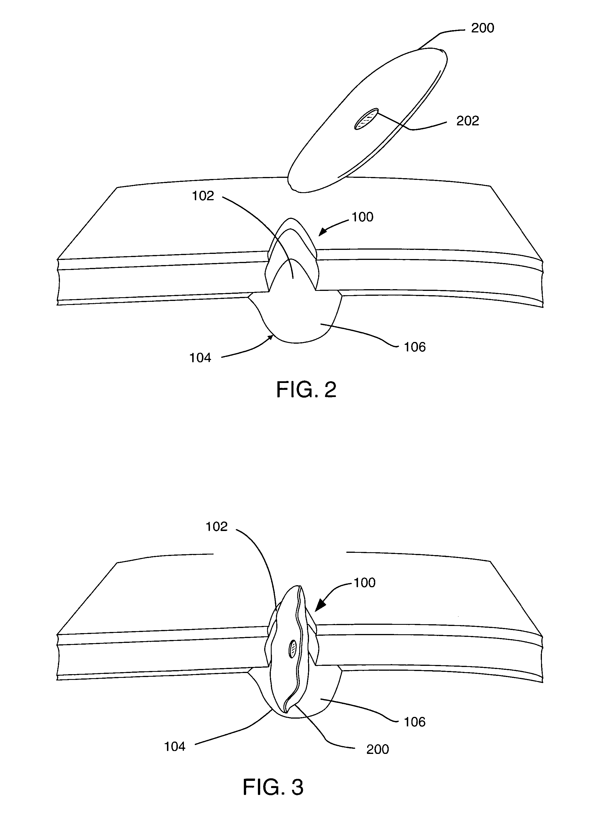 Methods and apparatus for the repair of hernias