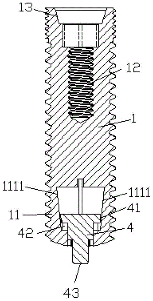 Closed implants with spontaneous elastic expansion