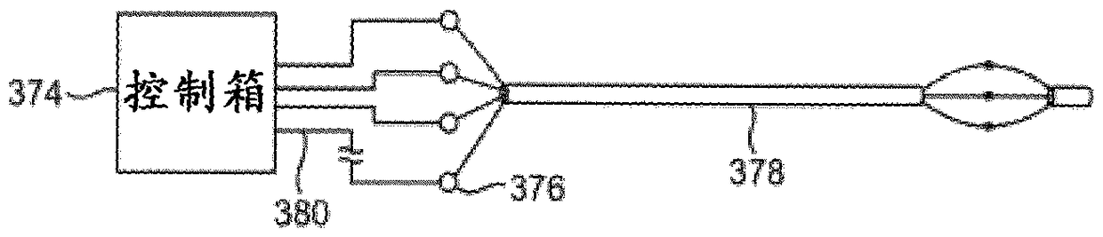 Device and method for treating in-stent restenosis