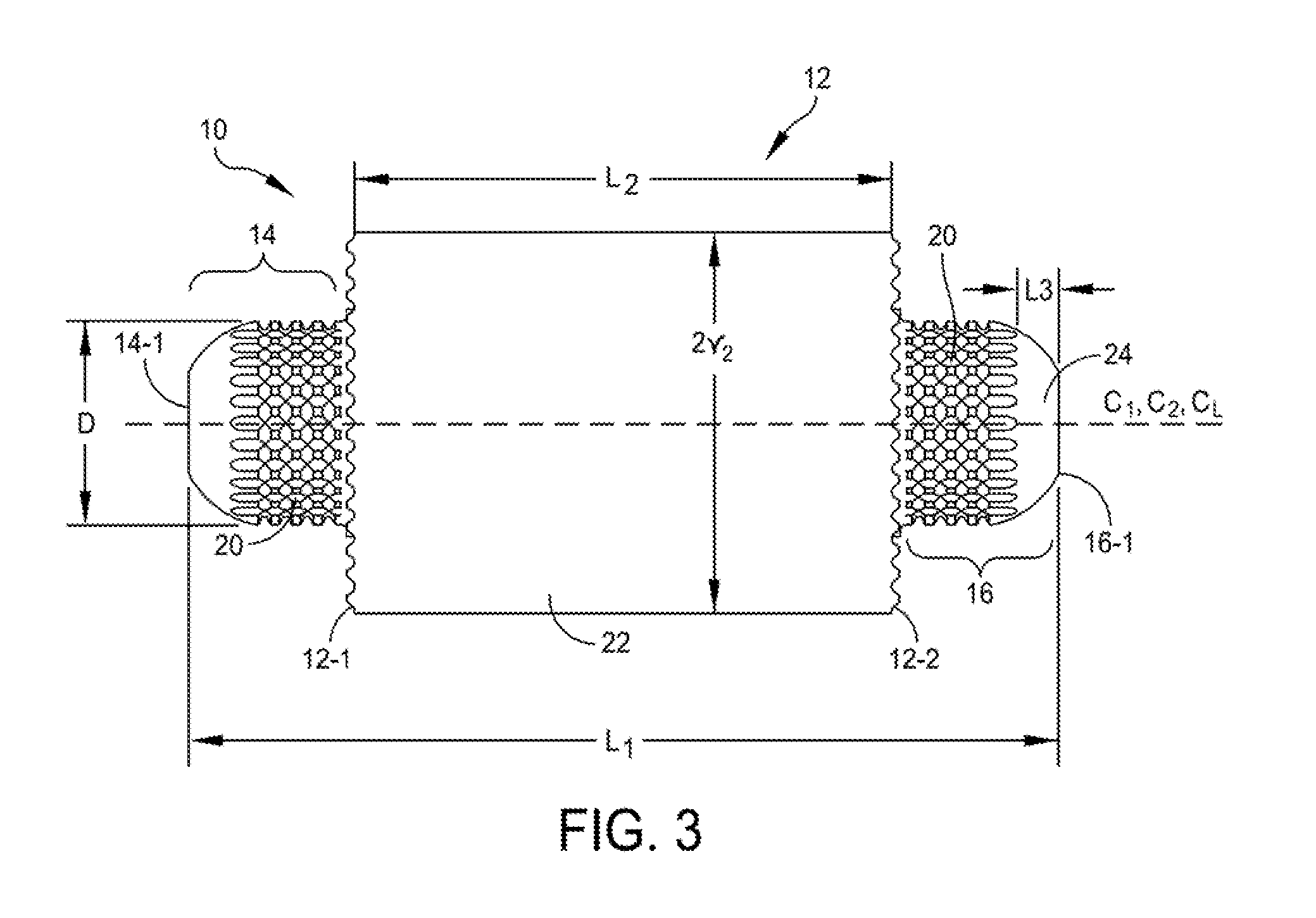 Joint implant, method of making and surgical procedure for implanting the same