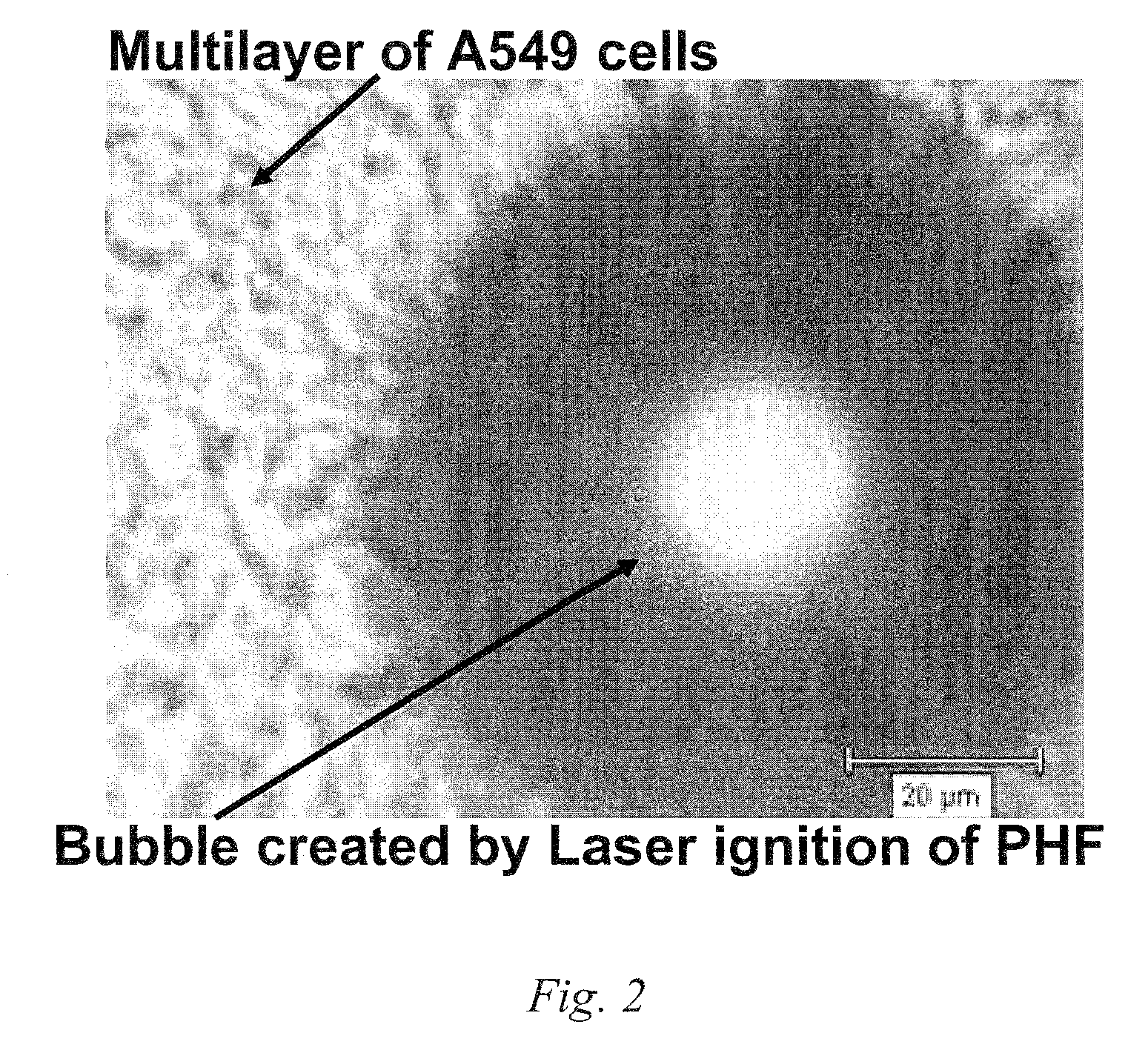 Systems and methods based on radiation induced heating or ignition of functionalized fullerenes