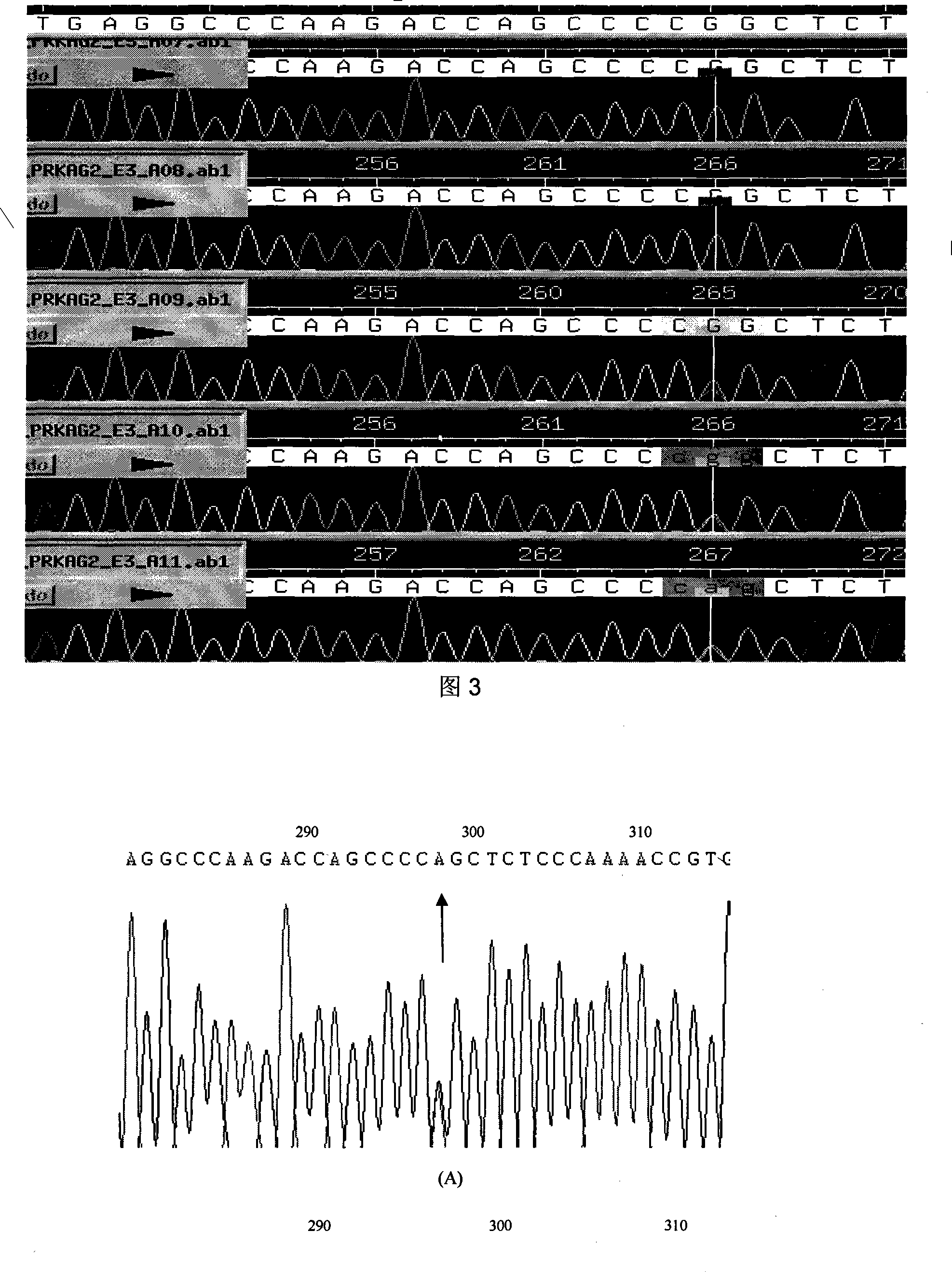 Hypertrophic type cardiomyopathy PRKAG2 gene mutation and detecting method thereof