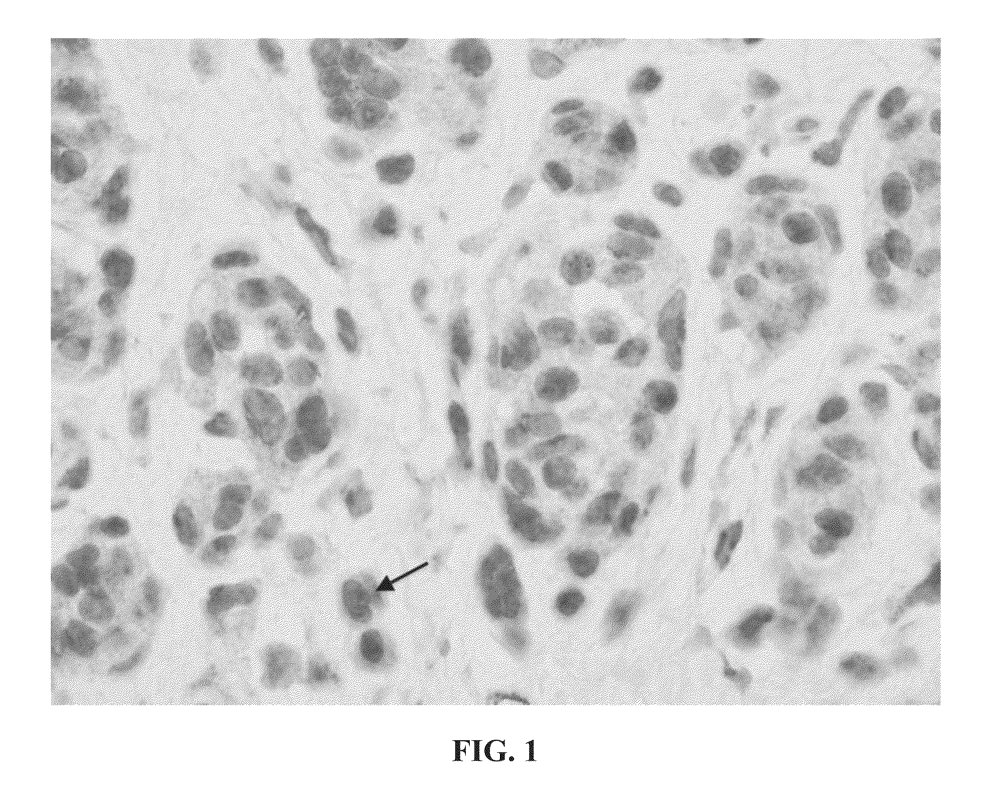 Method for diagnosing melanocytic proliferations