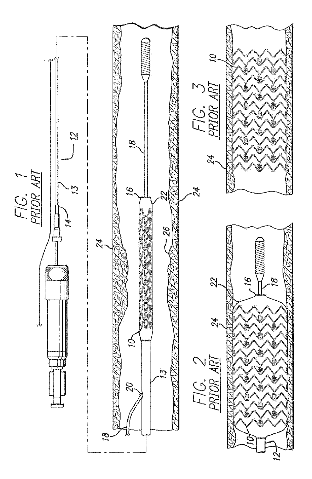 Intravascular stent having high fatigue performance