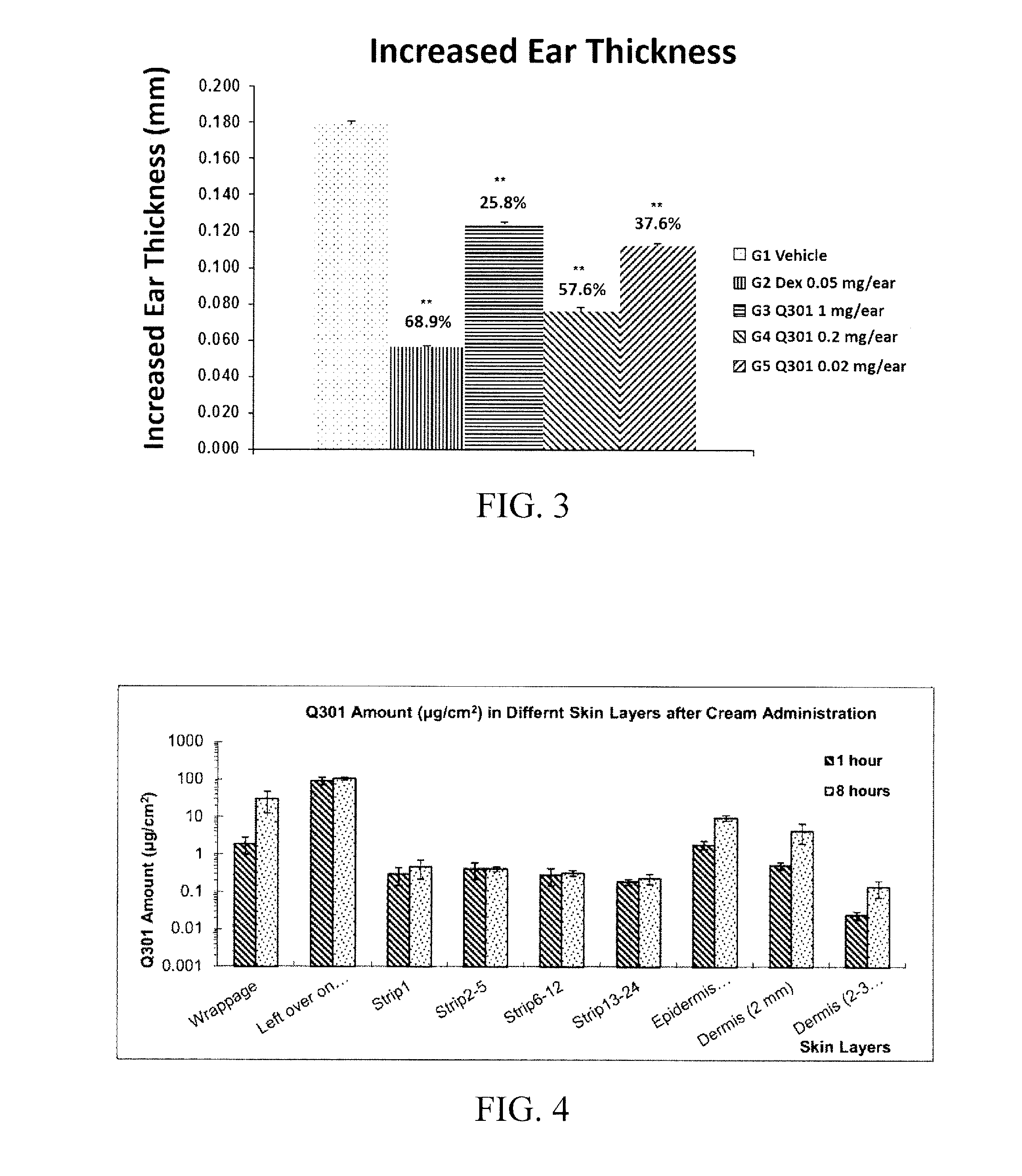 Topical Anti-inflammatory pharmaceutical composition with zileuton cream formulation