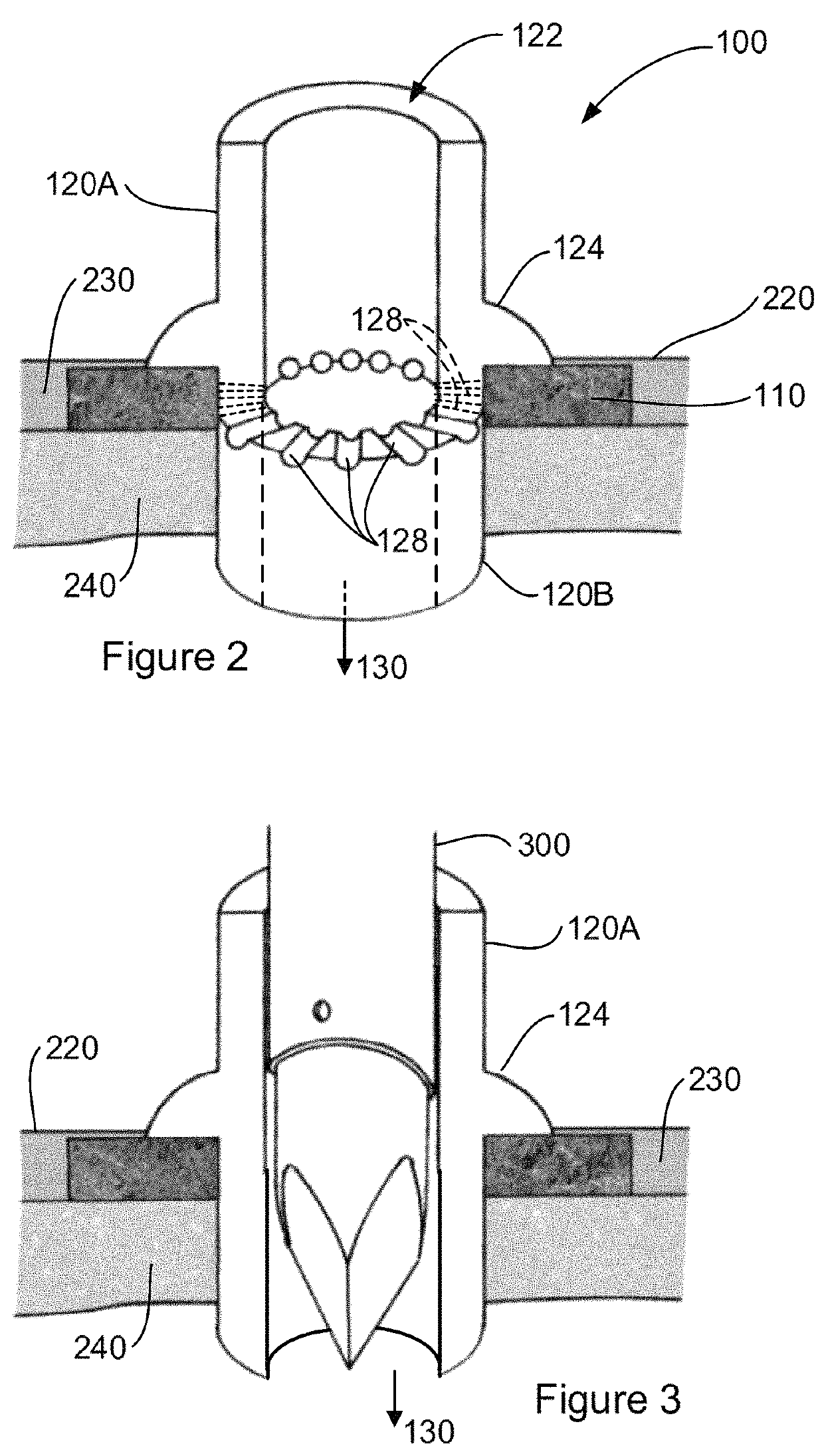 Implantable interface device