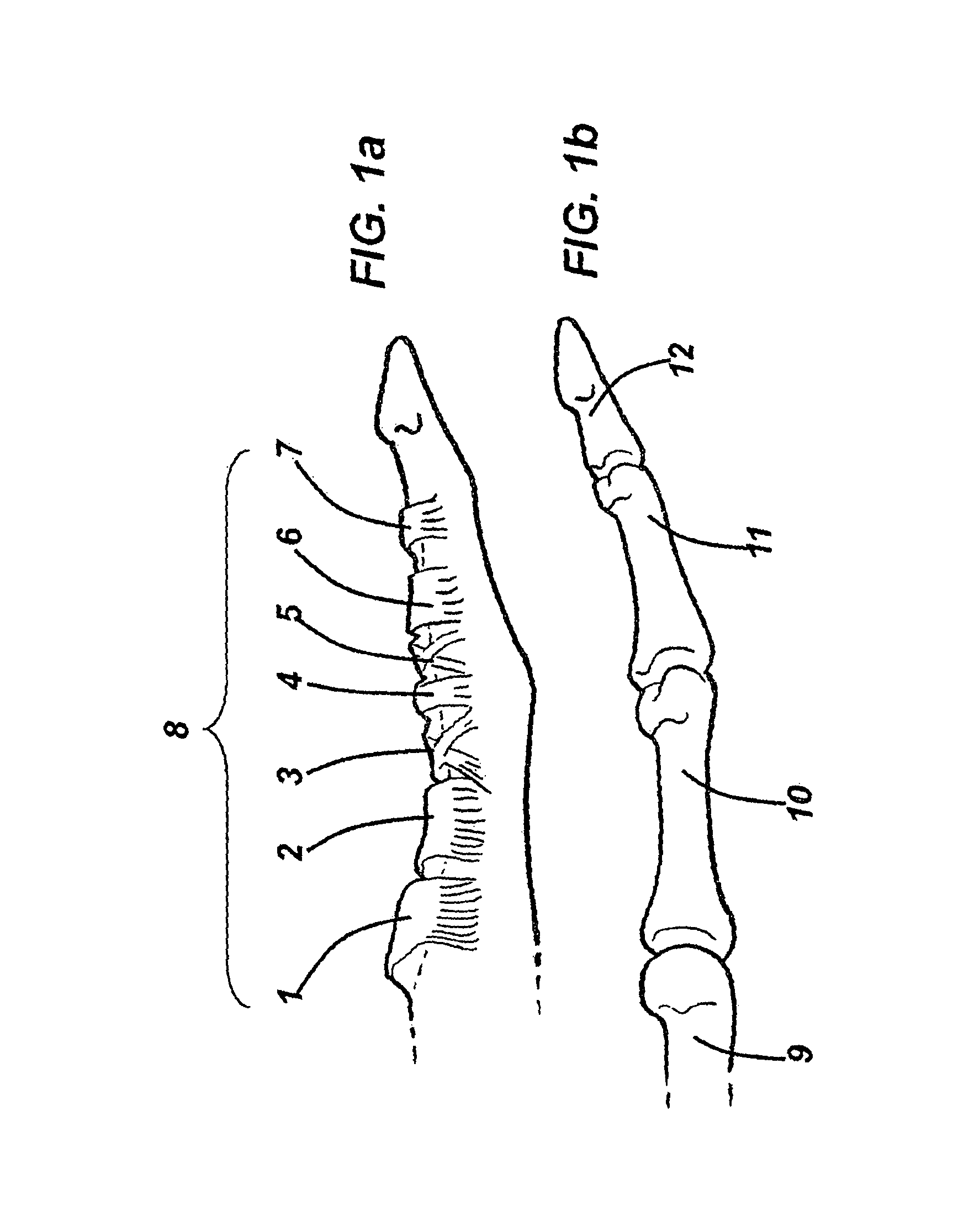 Device and method for assisting in flexor tendon repair and rehabilitation