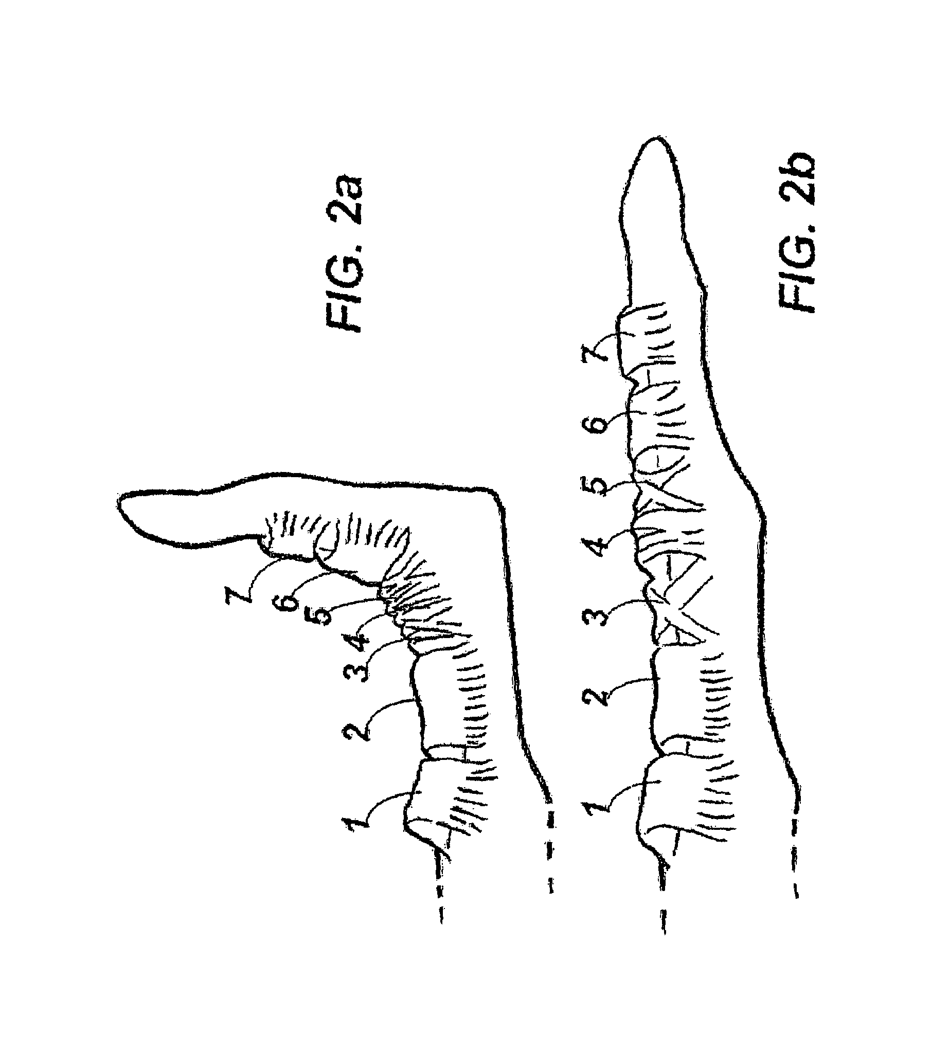 Device and method for assisting in flexor tendon repair and rehabilitation