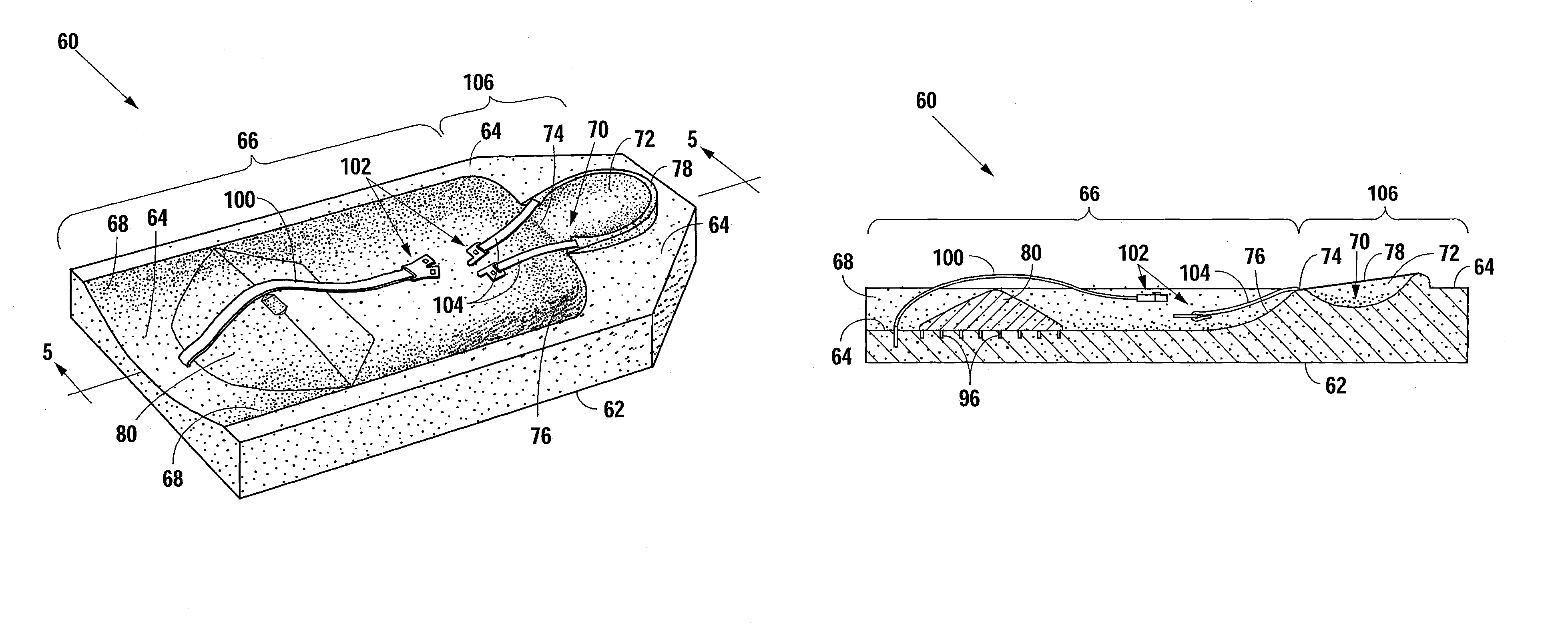 Mattress incorporating a headrest for preventing and correcting non-synostotic cranial deformities in infants