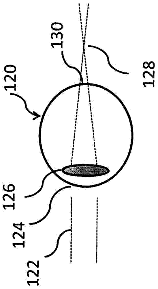 Lenses, devices, methods and systems for refractive errors