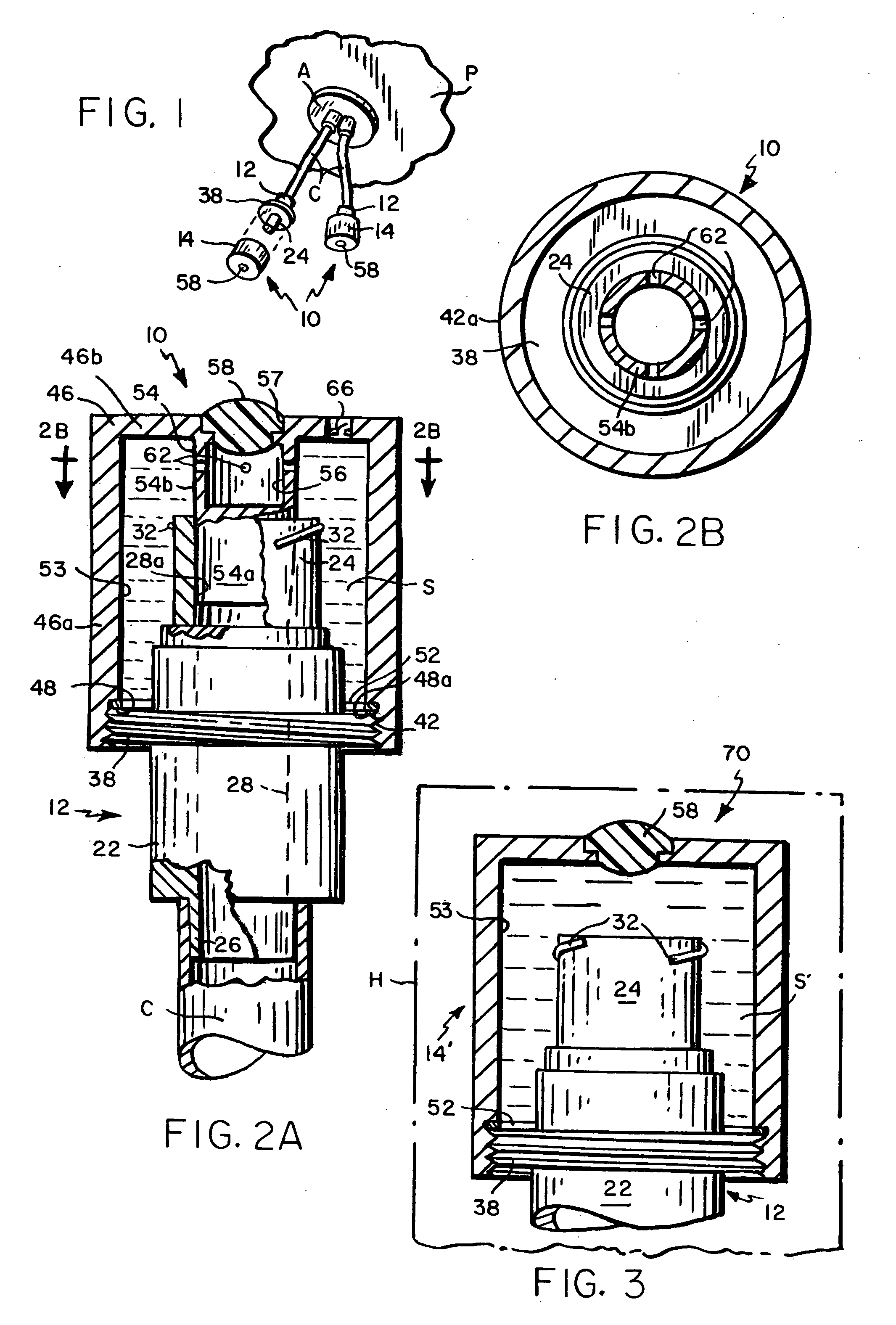 Sanitized tubing termination method and assembly