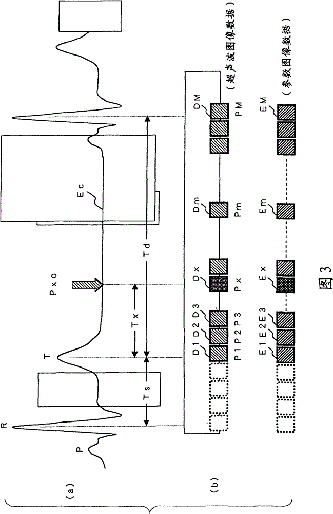 Ultrasonic diagnosis device, ultrasonic image analysis device, and ultrasonic image analysis method