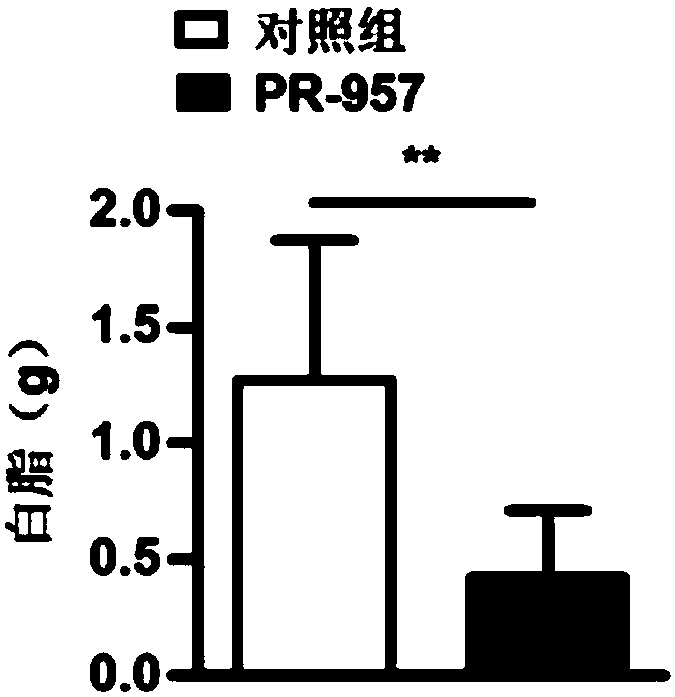Application of PSMB8 and PSMB8 inhibitor to preparation of medicine for treating fatty liver and related diseases