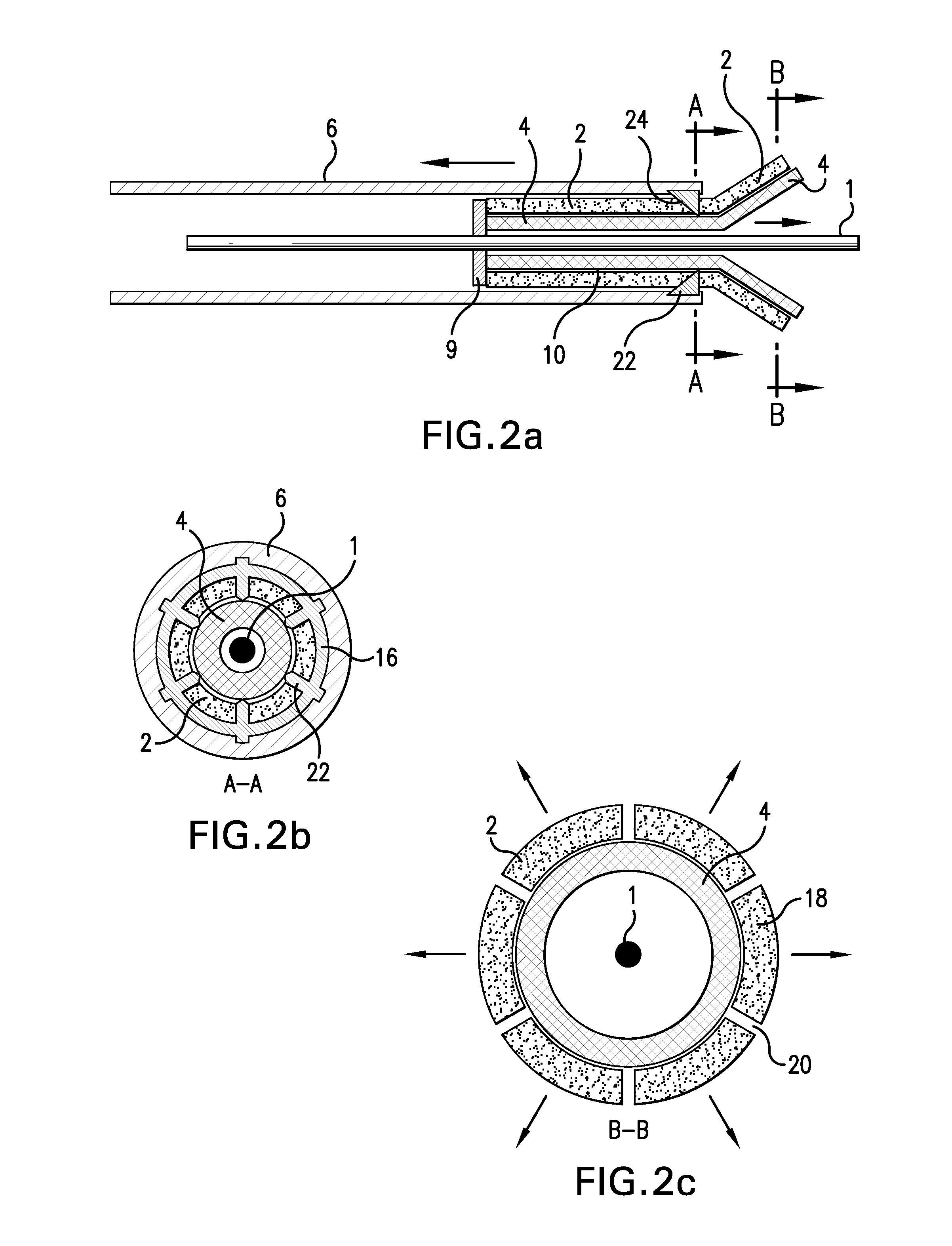 Self-expandable stent with a constrictive coating and method of use