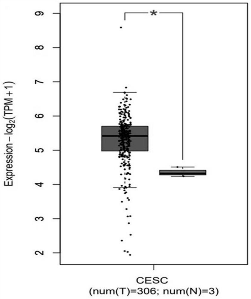 Application of TOP1 as cervical cancer marker and/or therapeutic target