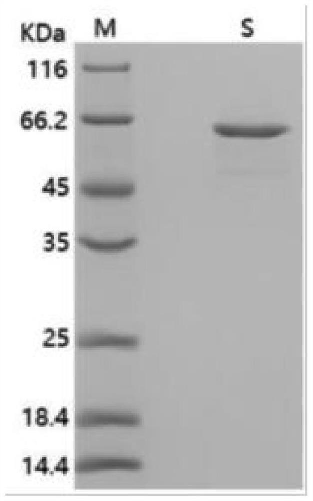 Rhodococcus pyridinivorans polyhydroxyalkanoate synthetase, coding gene and application thereof