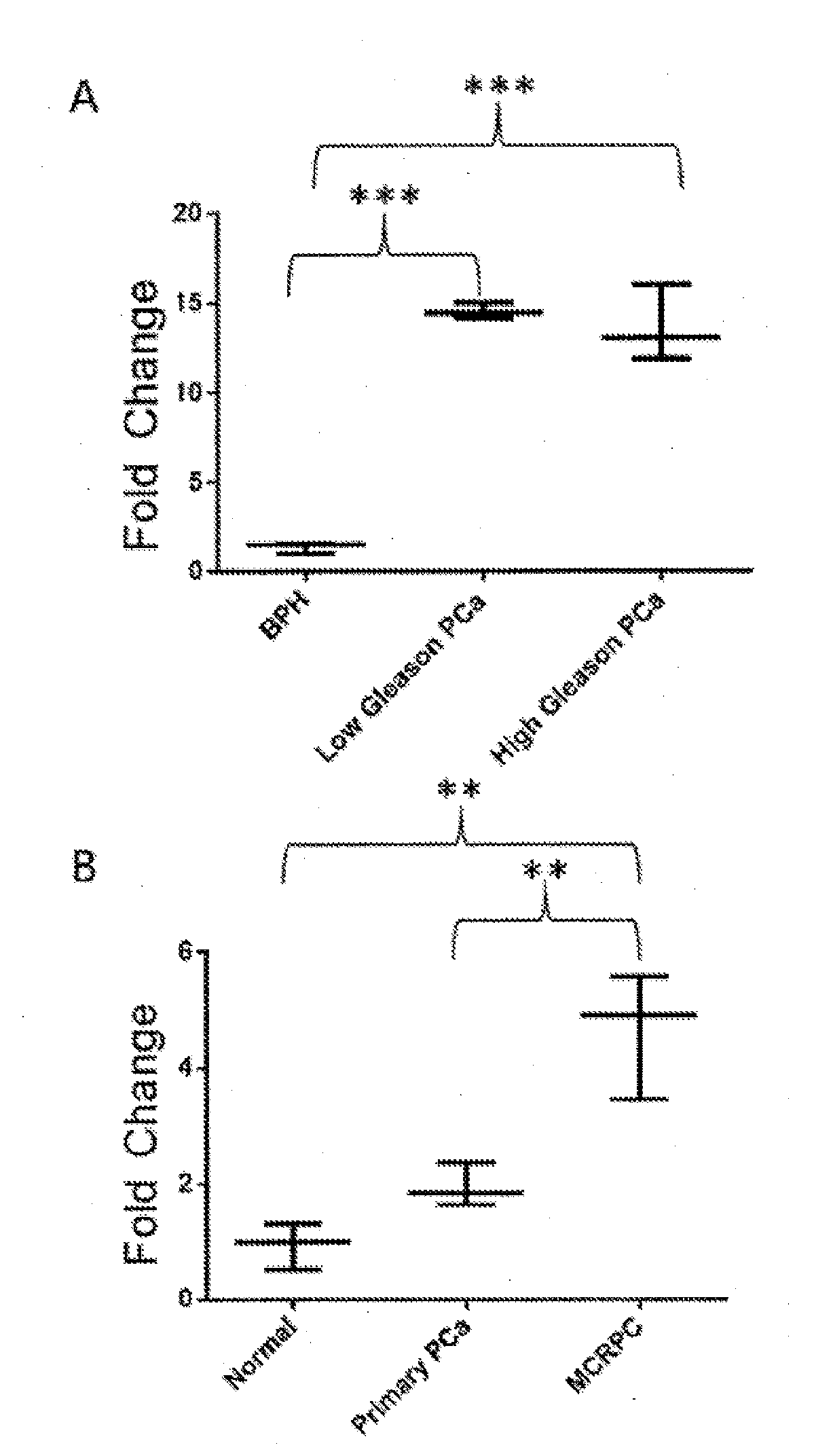 Methods and uses for diagnosis and treatment of prostate cancer