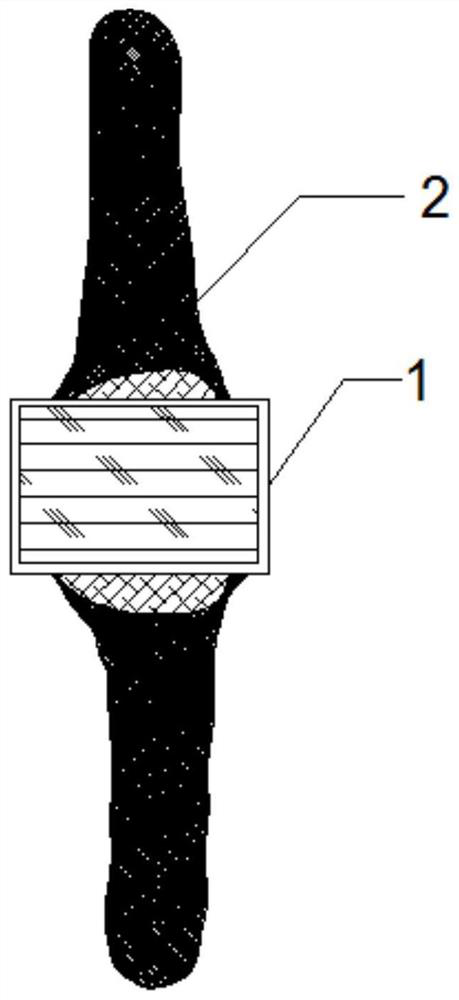 Bone joint external use bag and preparation method thereof