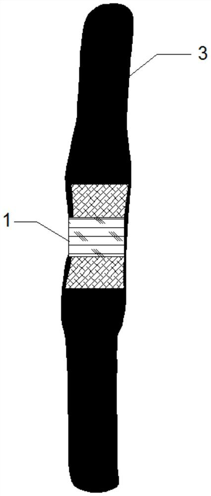 Bone joint external use bag and preparation method thereof