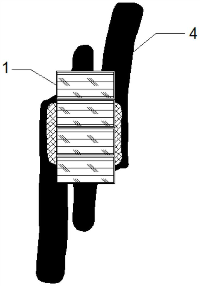 Bone joint external use bag and preparation method thereof