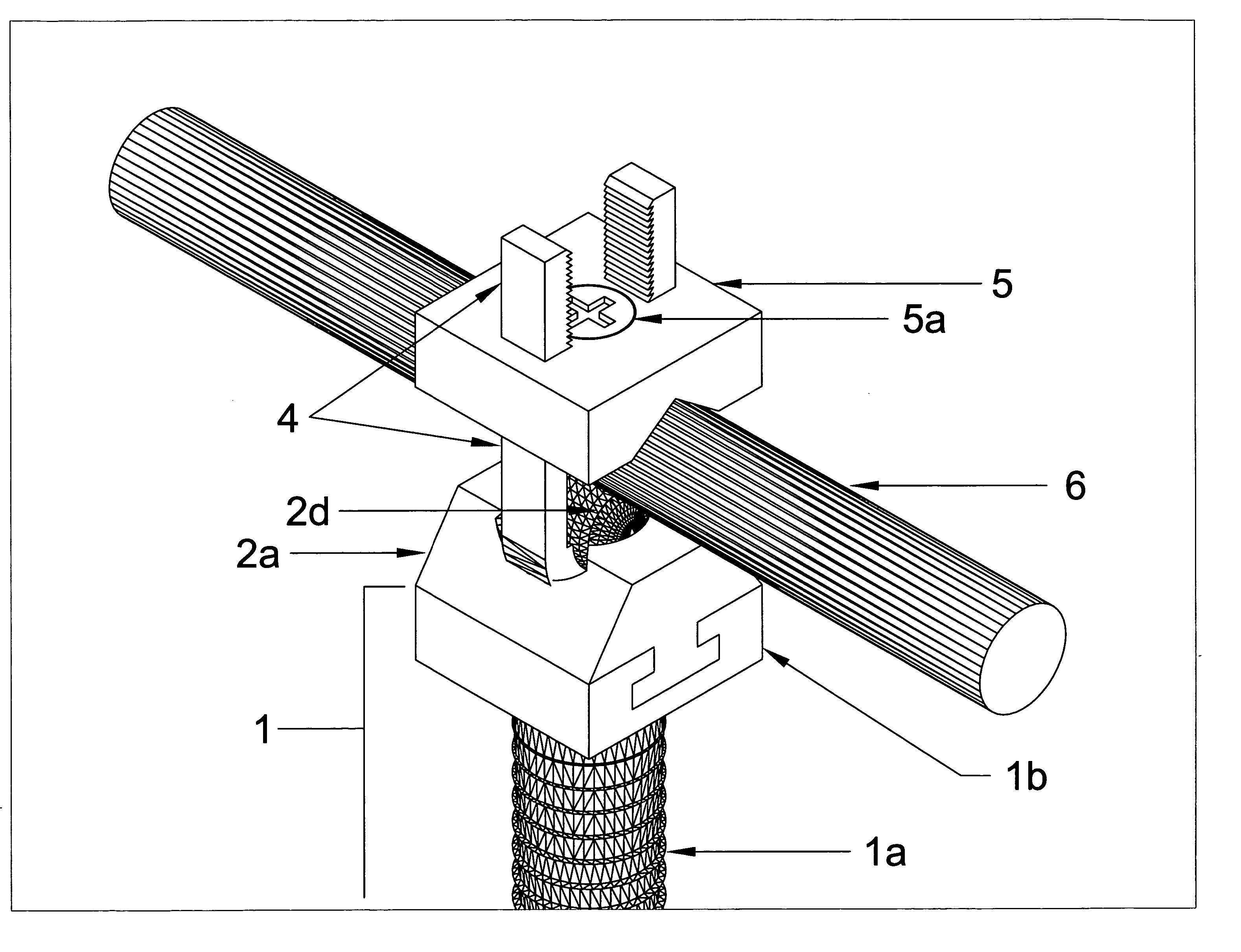 Modular spinal fixation system