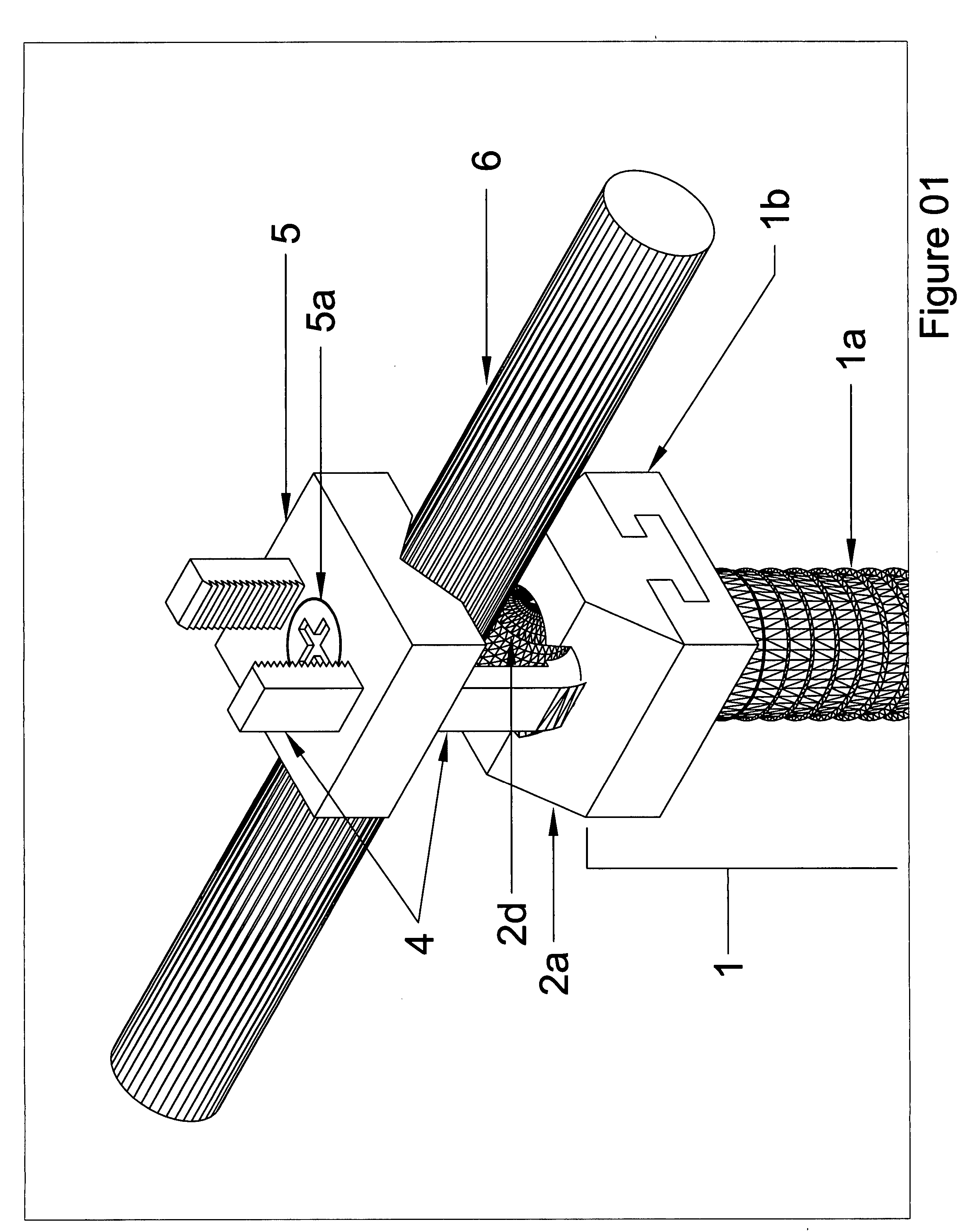 Modular spinal fixation system