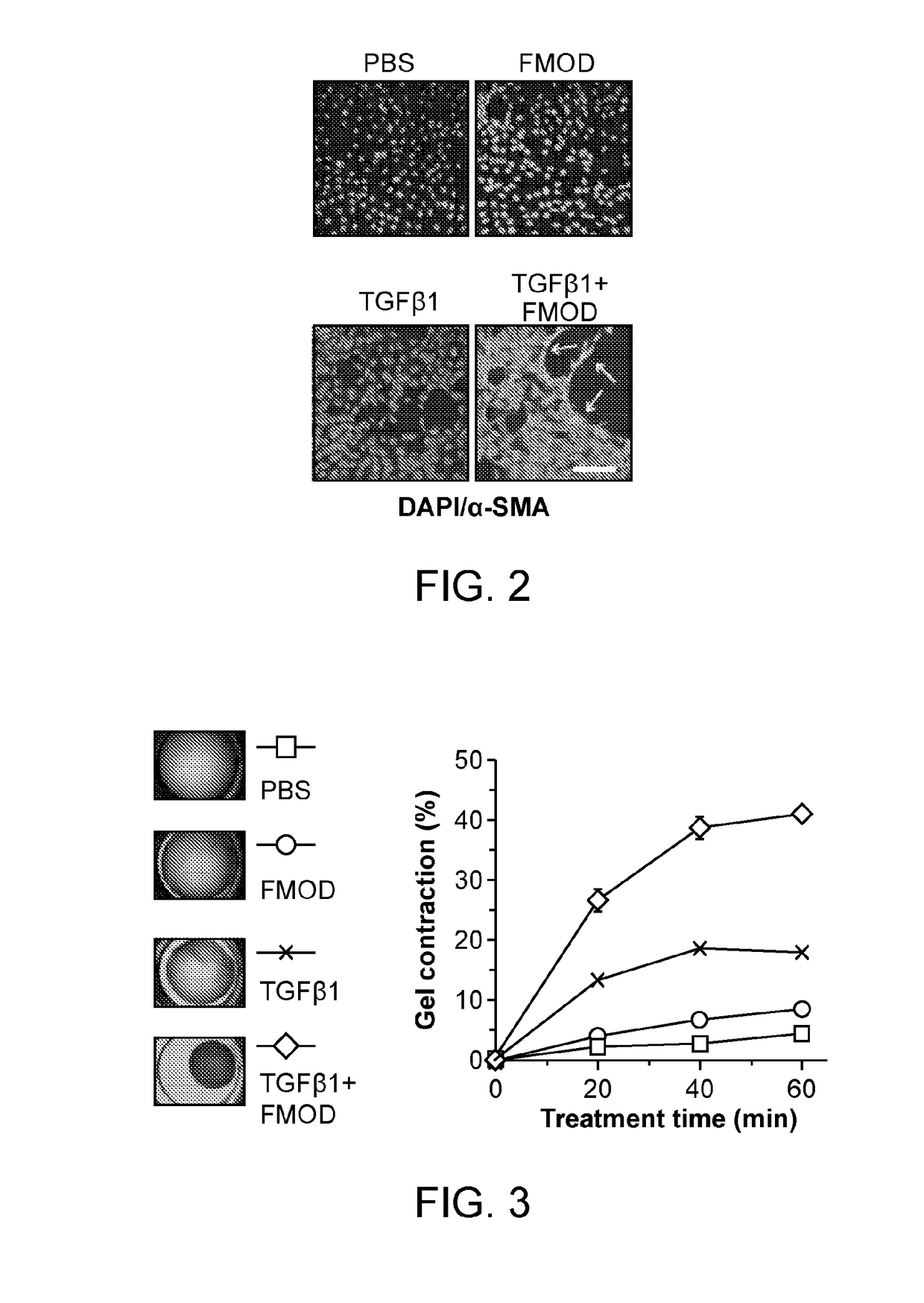 Methods and compositions for modulating myofibroblast activities