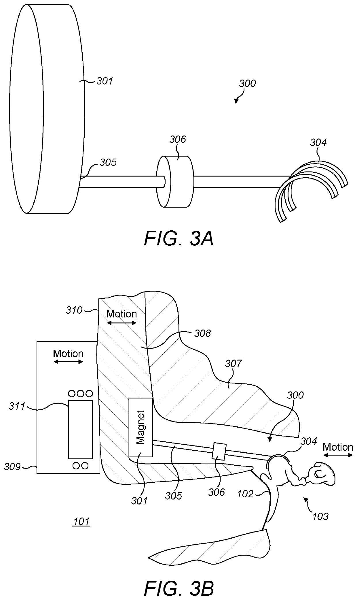 Universal bone conduction and middle ear implant