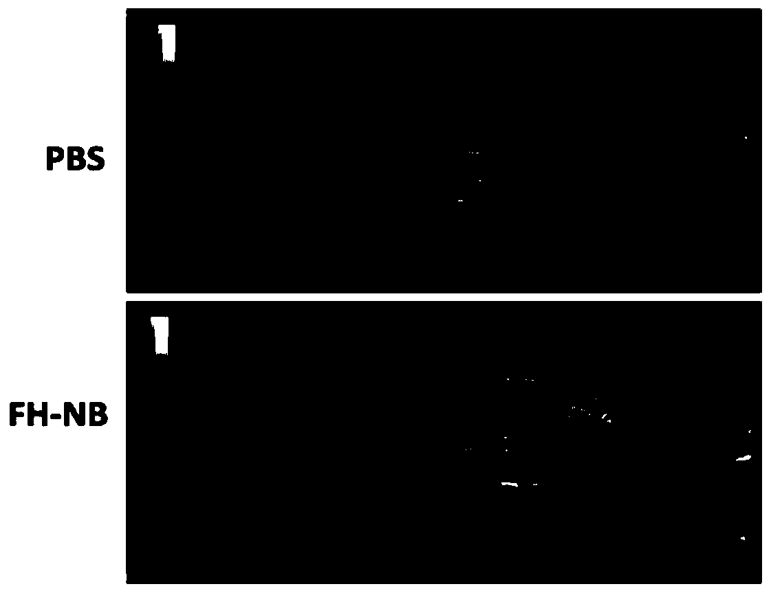 Adriamycin-carrying lipid nanoscale ultrasound contrast agent targeting tumor-related fibroblasts and preparation method of adriamycin-carrying lipid nanoscale ultrasound contrast agent