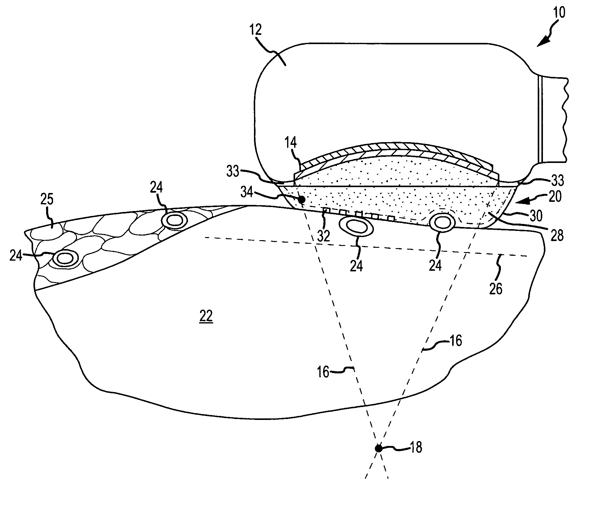 Apparatus and method for tissue ablation with near-field cooling