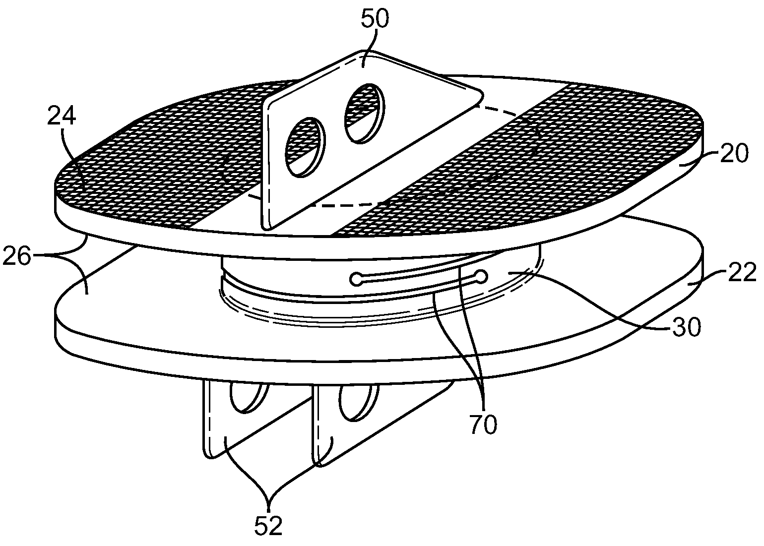 Dynamic Spacer Device and Method for Spanning a Space Formed upon Removal of an Intervertebral Disc