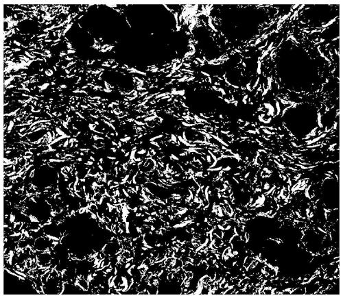 Evaluation method of collagen tissue at the resection margin of rectal cancer resection specimens