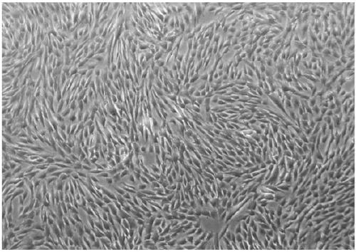 Method for differentiation of amniotic fluid mesenchymal stem cells into neural stem cells