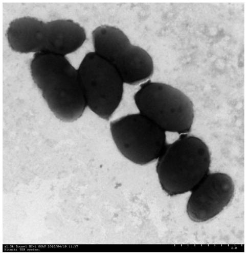 Strain HB161398 with nitrogen fixation activity and application thereof